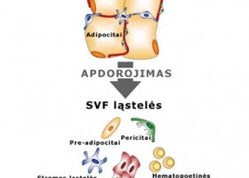 Įrašo "Stromos vaskuliarinės frakcijos (SVF) ląstelių išskyrimo iš riebalinio audinio būdas ir jų panaudojimas" reprezentacinis paveikslėlis