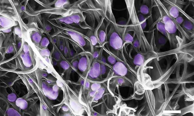 Paveikslėlyje: H5N2 paukščių gripo viruso (violetinė spalva), įstrigusio anglies nanovamzdelių masyve, vaizdas, gautas rastriniu elektroniniu mikroskopu.