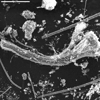Pro mikroskopą matomas chrizotilo pluoštas