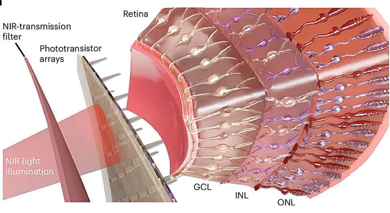 this artificial retina